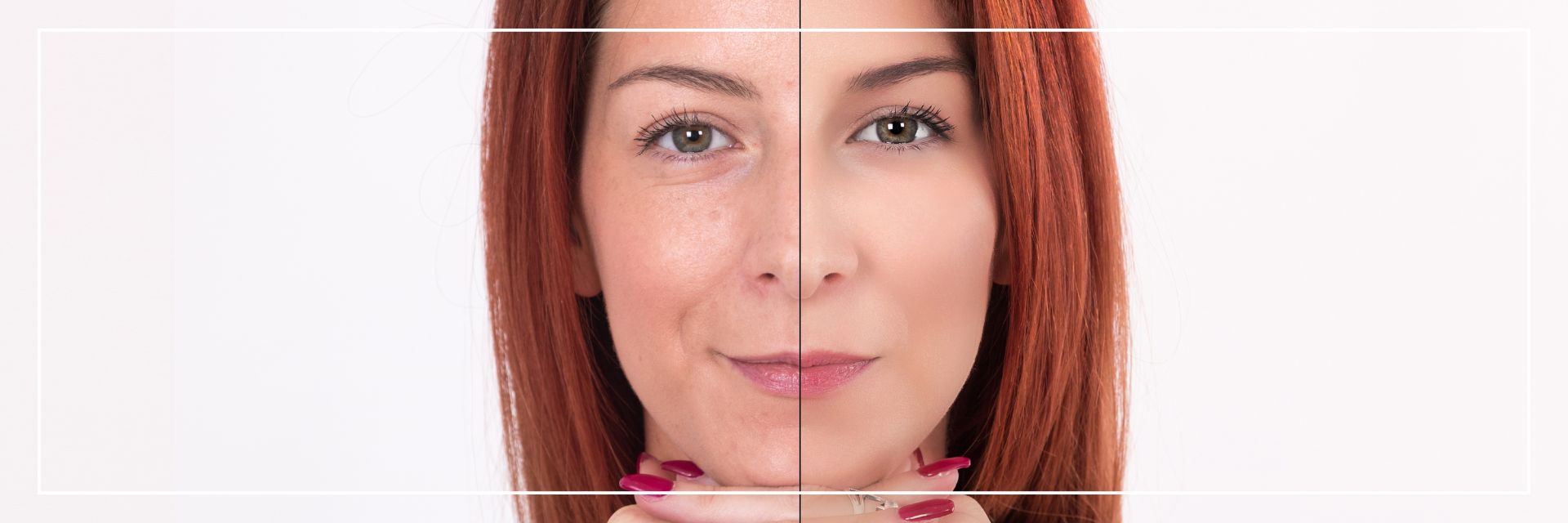 Marine Collagen for Skin Hydration and Glow: Why It’s a Must-Have in Your Routine