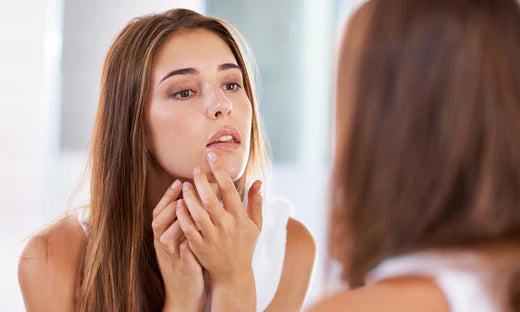 Treating Cystic Acne: 3 Ways to Treat the Stubborn Devil Zits Fast with The Minies
