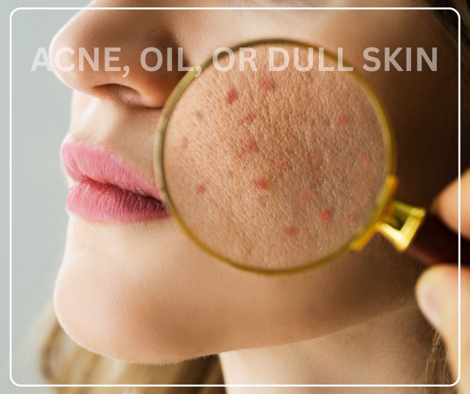 Acne, Oil, or Dull Skin? How Green Tea Face Wash Can Help