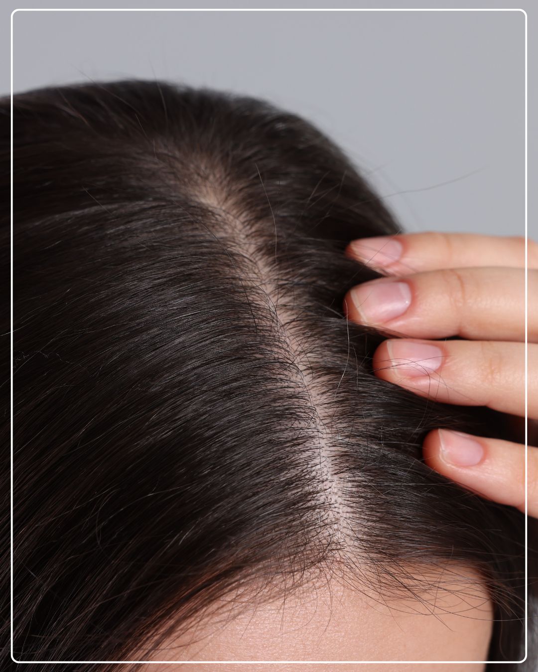 Daily Leave-In Scalp Treatment