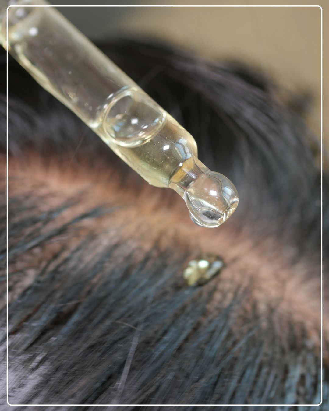 Deep Scalp Nourishment & Hydration