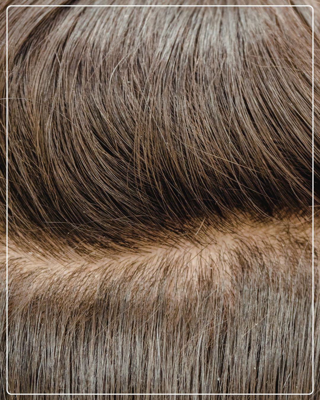Supports Stronger Roots & Reduced Hair Fall