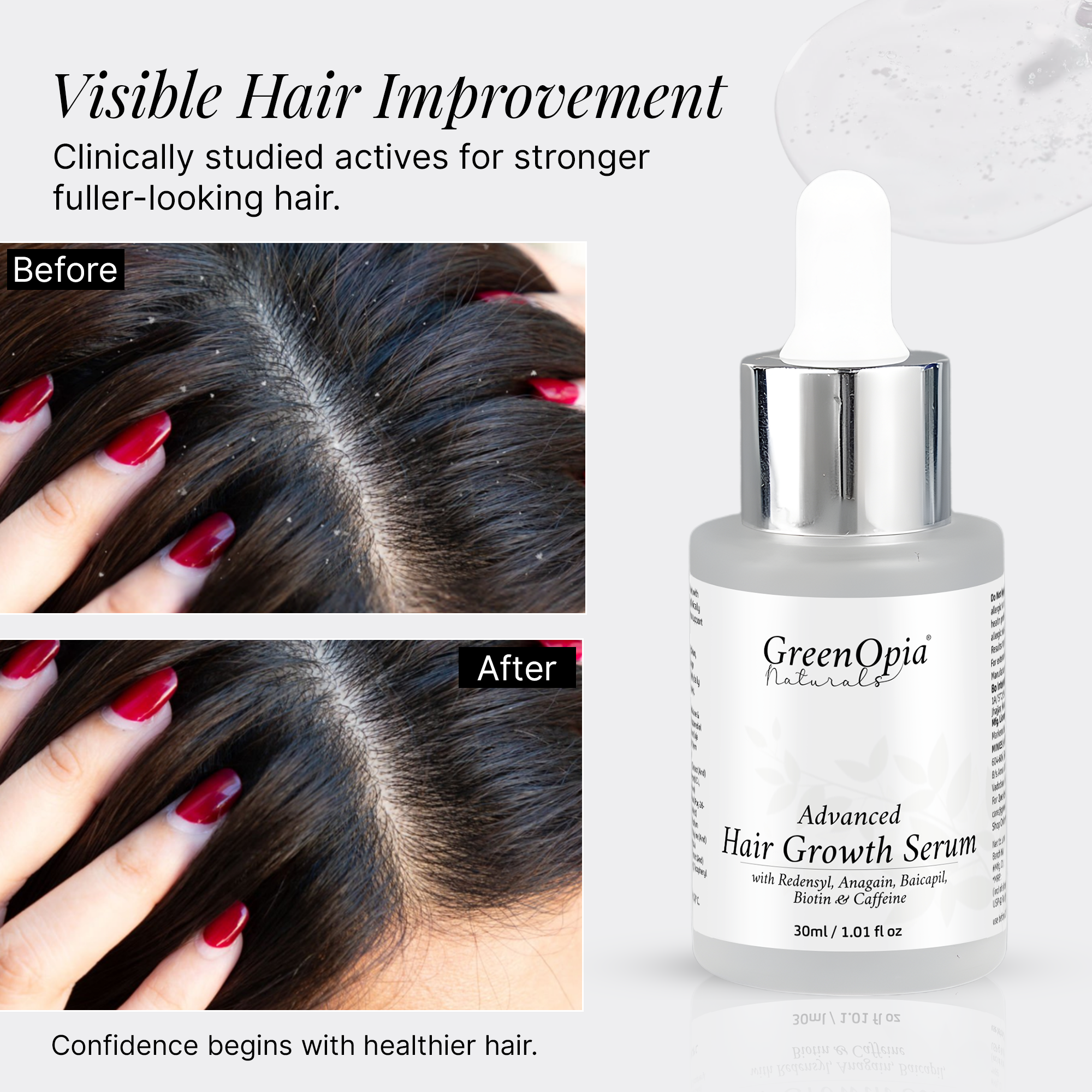 GreenOpia Advanced Hair Growth Serum For Men & Women