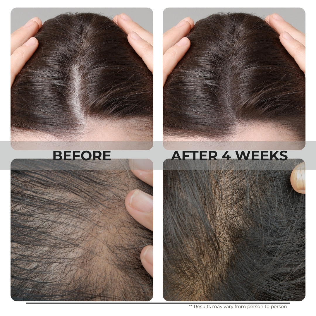 GreenOpia Advanced Hair Growth Serum For Men & Women